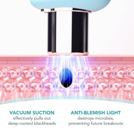 Effective Blackhead Remover