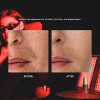 Anti-Aging LED Light Therapy Pane Double 