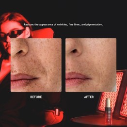 HoMedics Illumi Hot Cold Beauty Treatment Device