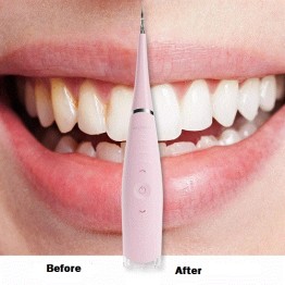 Sonic Tooth Cleaner For Tartar