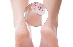 Foot Hard Skin Removers and Devices
